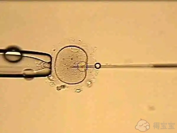 宁德哪些医院能做a卵b怀-在进行输卵管灌洗术的当月能怀孕吗？手术前要做哪些检查？